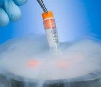 试管婴儿的发展和现状